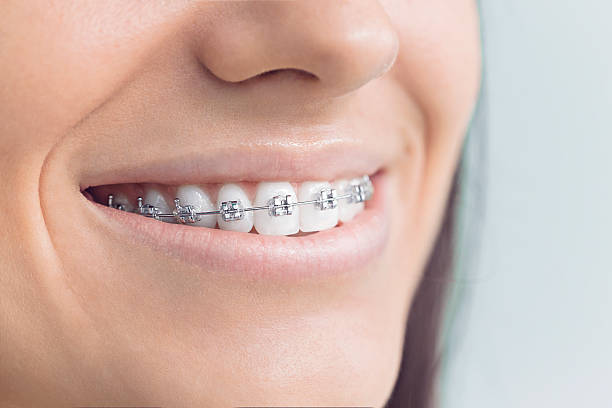 Best Traditional Braces  in Casselberry, FL